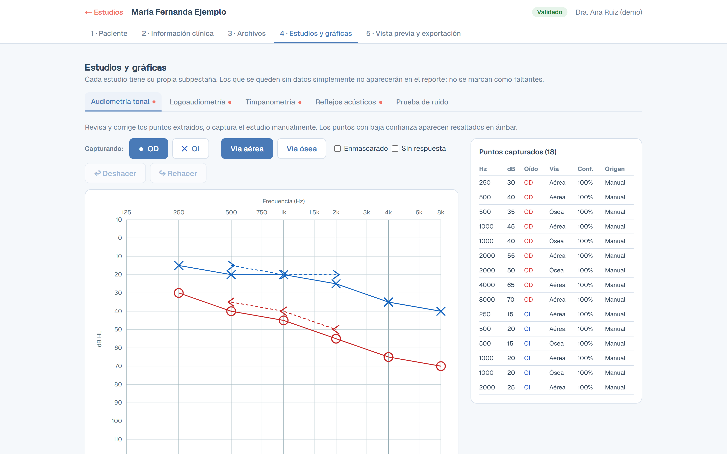 Sonovit report tool — audiogram entry screen